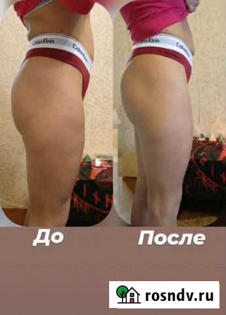 Массаж. Коррекция фигуры. мфр Сафоново - изображение 1