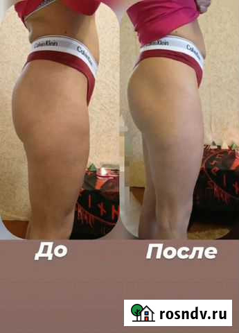 Массаж. Коррекция фигуры. мфр Сафоново - изображение 1