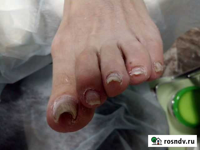 Подолог Нижний Новгород - изображение 1