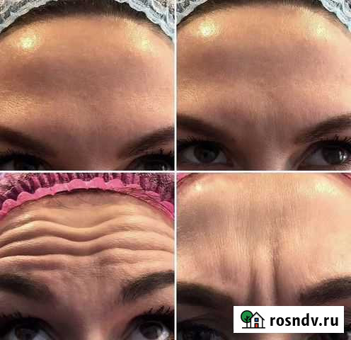 Эстетическая косметология Горно-Алтайск - изображение 1