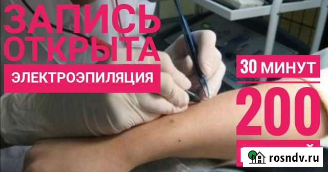 Электроэпиляция Омск - изображение 1