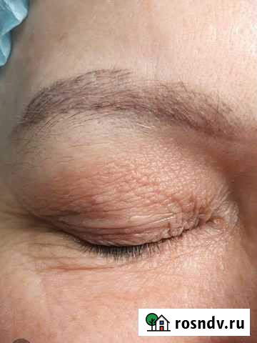 Удаление грехов молодости и неудач с тату и татуаж Оренбург - изображение 1