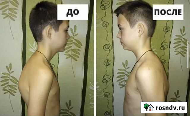 Массаж classic Черкесск - изображение 1