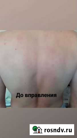 Услуги Костоправа Ставрополь - изображение 1