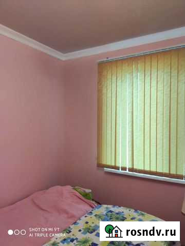 Внутренные работы Акуша - изображение 1