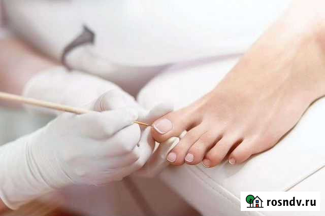 Нужны модели на педикюр Барнаул - изображение 1