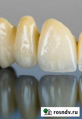 Частный зубной техник Тюмень - изображение 1