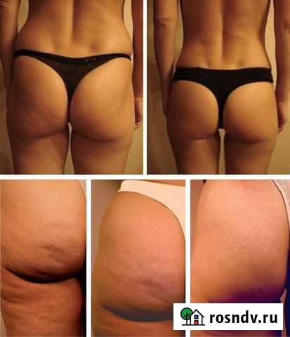 Массаж Киров - изображение 1