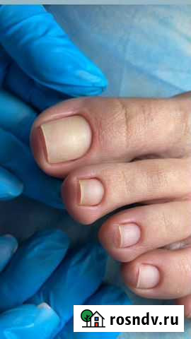 Аппаратный педикюр Владикавказ - изображение 1