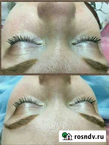 Чистка лица, карбоновый, алмазный, РФ лифтинг лица Оренбург - изображение 1