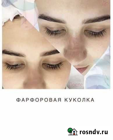 Фарфоровая куколка+чистка лица Махачкала - изображение 1