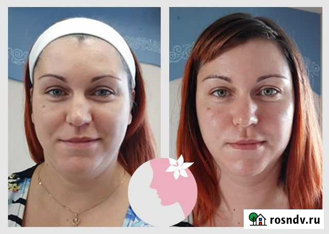 Пилинг лица мягкий коррекционный Челябинск - изображение 1