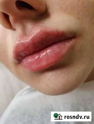 Косметология косметолог Мурино - изображение 1