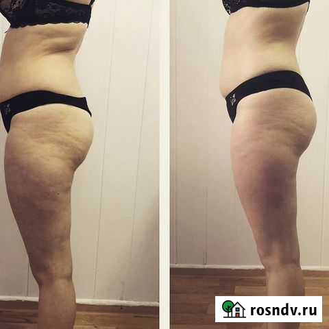 Расслабляющий массаж, швз, общий, вакуумный массаж Кемерово - изображение 1