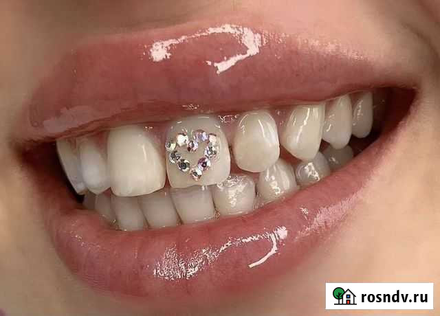 Модель на скайсы Кострома - изображение 1