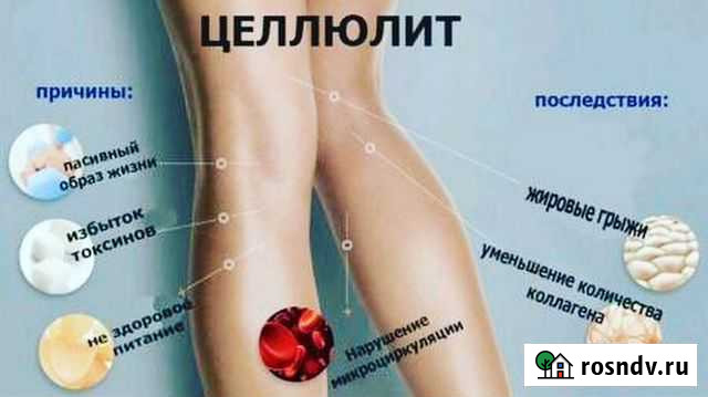 Lpg-массаж Тамбов - изображение 1