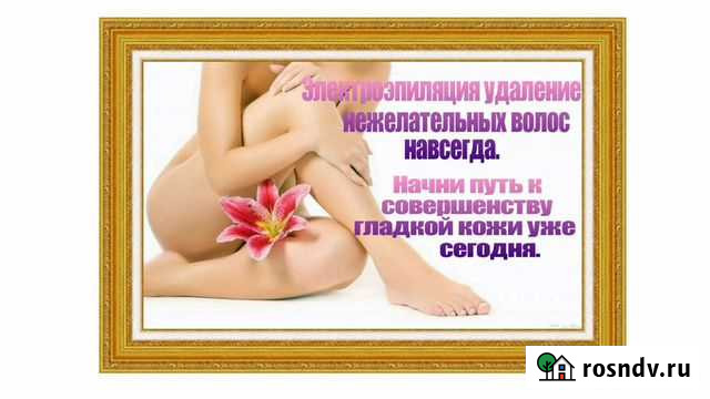 Электроэпиляция Нальчик - изображение 1