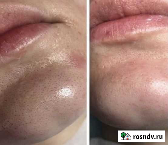 Услуги косметолога Видное - изображение 1