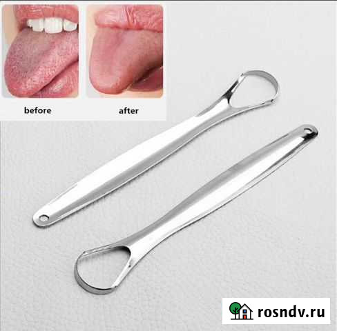 Скребок для языка Йошкар-Ола - изображение 1
