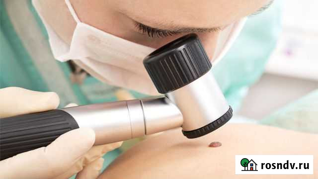 Лазерное удаление новообразований на коже Уфа - изображение 1