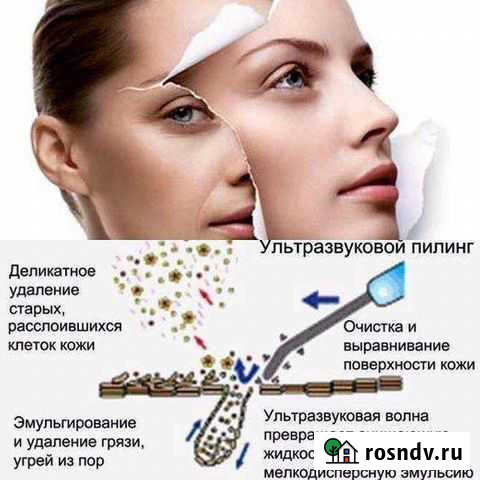 Уз чистка лица Великий Новгород - изображение 1