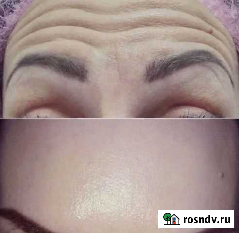 Косметология Ефремов - изображение 1