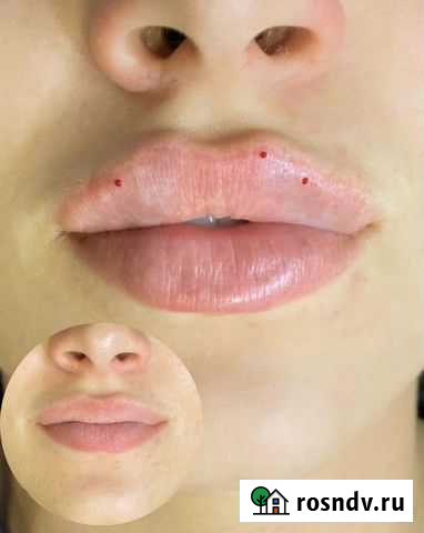 Косметолог, губы, full face, контурная пластика Санкт-Петербург - изображение 1