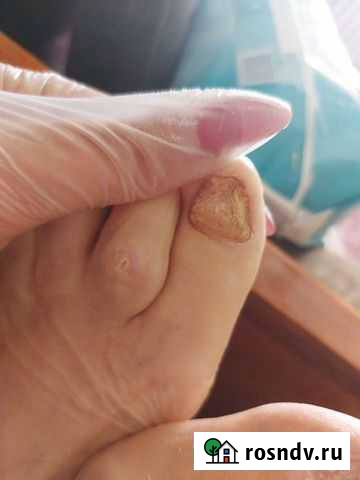 Педикюр на дому Санкт-Петербург - изображение 1