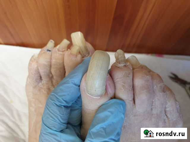 Педикюр с выездом на дом/пожилым Новосибирск - изображение 1