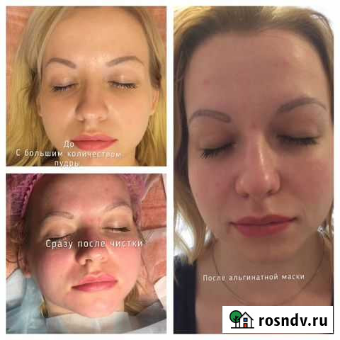 Чистка лица + альгитнаям маска Санкт-Петербург - изображение 1