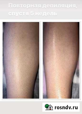 Шугаринг Магнитогорск - изображение 1