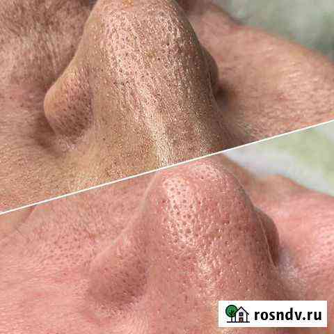 Косметолог чистка лица Уфа