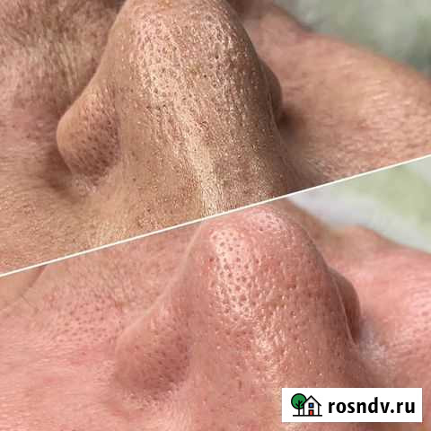 Косметолог чистка лица Уфа - изображение 1