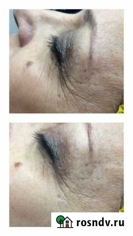 Косметолог-эстетист Челябинск - изображение 1