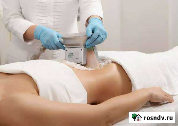 Криолиполиз Киров - изображение 1