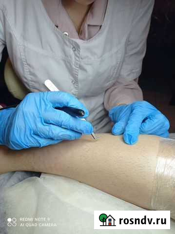 Мастер электроэпиляции Ростов-на-Дону - изображение 1