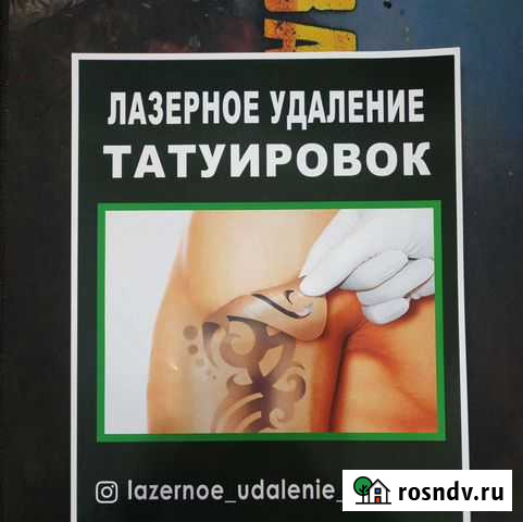 Лазерное удаление татуировок Хасавюрт - изображение 1