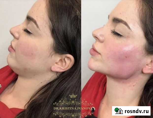 Косметолог, Большой спектр услуг.anti-AGE Санкт-Петербург - изображение 1