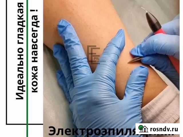 Электроэпиляция Тверь - изображение 1