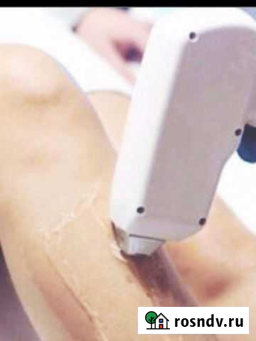 Лазерная эпиляция Махачкала - изображение 1