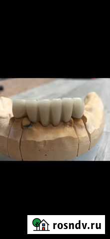 Зубной техник- сотрудничество с врачом ортопепедом Набережные Челны - изображение 1