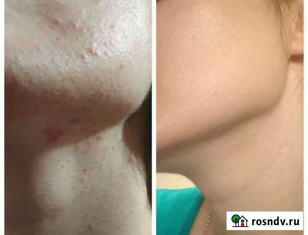 Косметолог р-н Цирка Воронеж - изображение 1