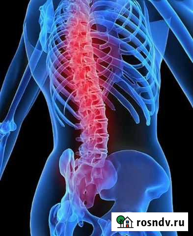 Массаж,костоправство Киров - изображение 1