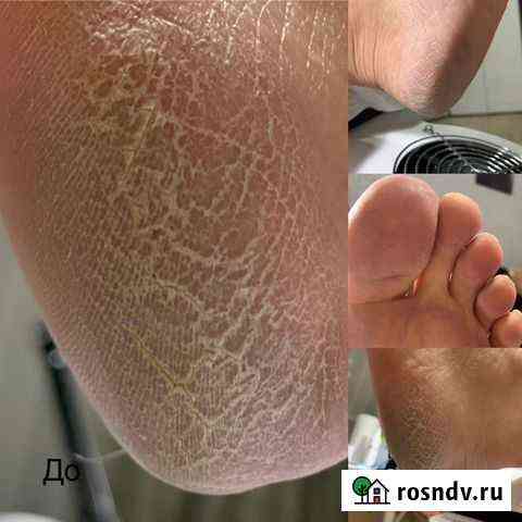 Педикюр на дому Первомайский