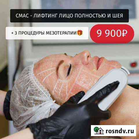 Smas lifting Москва