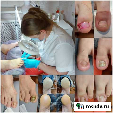 Подолог Ростов-на-Дону - изображение 1