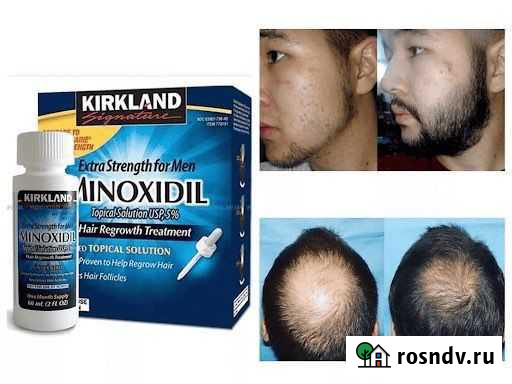 Минокс для роста бороды Грозный - изображение 1