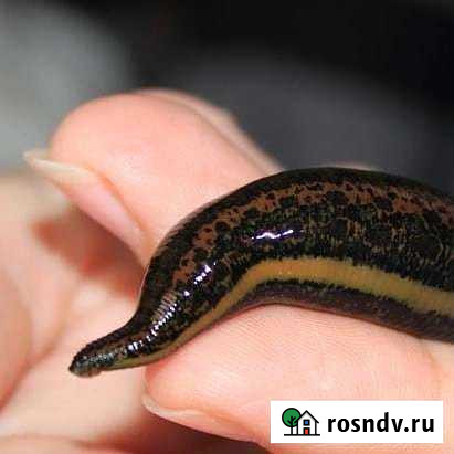 Пиявки Москва - изображение 1