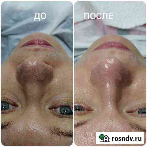 Косметолог. Требуются модели для портфоли Санкт-Петербург