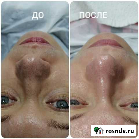 Косметолог. Требуются модели для портфоли Санкт-Петербург - изображение 1